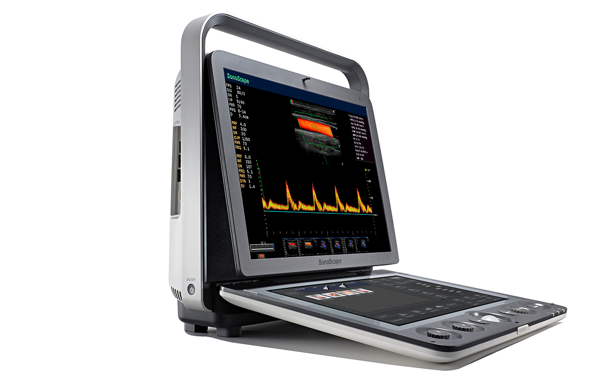 开立S9便携式彩色多普勒超声诊断仪